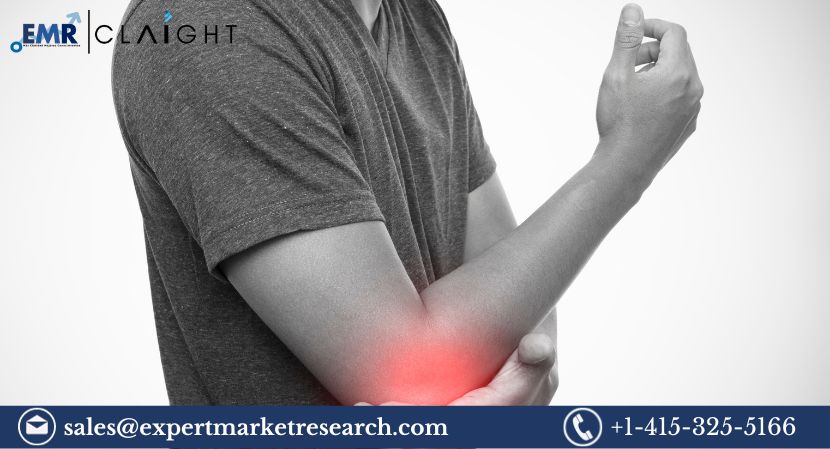 Read more about the article United States Topical Pain Relief Market Size, Share, Price, Trends, Growth, Analysis, Report, Forecast 2024-2032