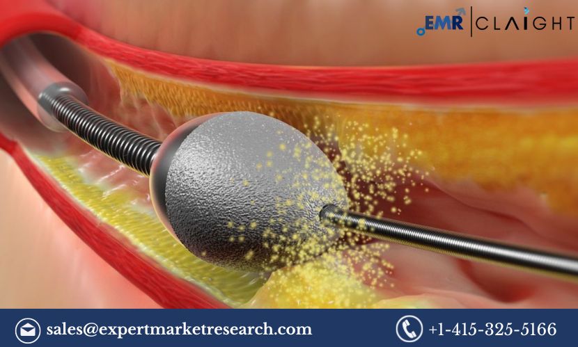 Read more about the article Global Atherectomy Devices Market Report and Forecast 2024-2032