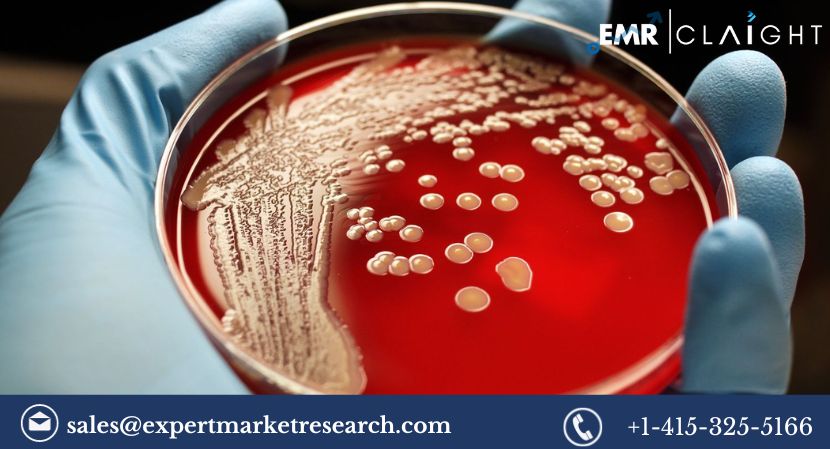 Read more about the article Global Bacterial Disease Diagnostics Market Size, Share, Report and Forecast 2024-2032