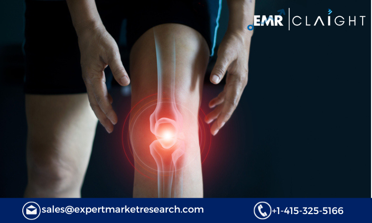 Read more about the article Bone and Joint Health Ingredients Market Size, Share, Report and Forecast 2024-2032