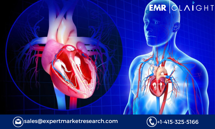 Read more about the article Global Cardiovascular and Soft Tissue Repair Patches Market Size, Share, Report and Forecast 2024-2032