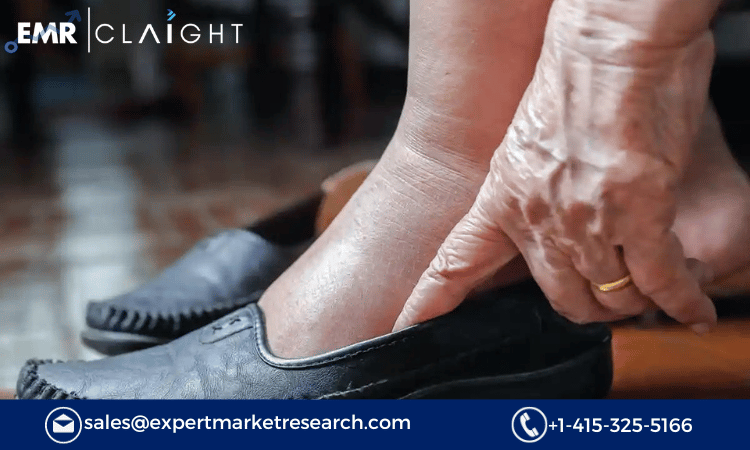 Read more about the article Diabetic Shoes Market Size, Share, Trends, Report and Forecast 2024-2032