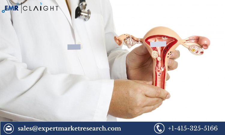 Read more about the article Endometrial Ablation Market Size, Share, Price, Trends, Growth, Analysis, Report and Forecast 2024-2032