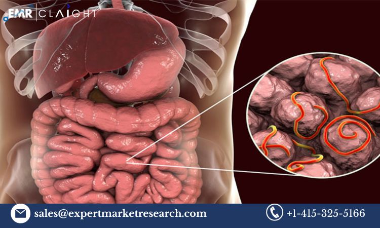 Read more about the article Global Gastroenterology Market Size, Share, Price, Trends, Growth, Analysis, Report and Forecast 2024-2032