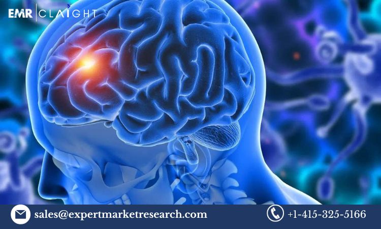 Read more about the article Glioblastoma Multiforme Treatment Market Size, Share, Price, Trends, Growth, Analysis, Report and Forecast 2024-2032