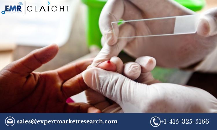 Read more about the article Global Malaria Diagnostics Market Size, Share, Report and Forecast 2024-2032