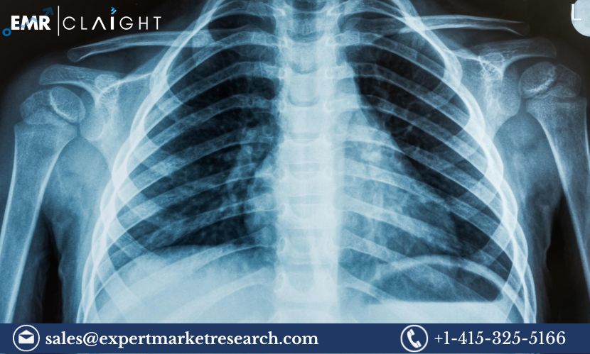 Read more about the article Global Medical X-ray Market Size, Share, Price, Trends, Growth, Analysis, Report and Forecast 2024-2032