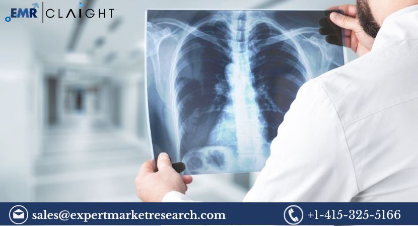 Read more about the article Global Medical X-Ray Market Size, Share, Growth, Report and Forecast 2024-2032