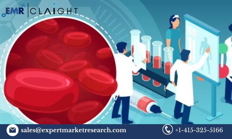 Read more about the article Neoantigen Cancer Vaccine Market Size, Share, Price, Trends, Growth, Analysis, Report and Forecast 2024-2032