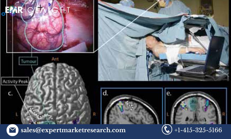 Read more about the article Global Neuronavigation Systems Market Size, Share, Price, Trends, Growth, Analysis, Report and Forecast 2024-2032