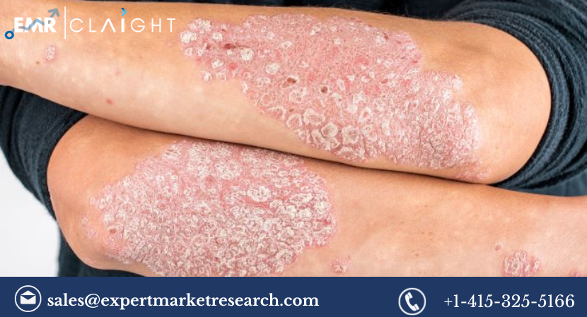 Read more about the article Plaque Psoriasis Treatment Market Share, Growth, Trends, Report and Forecast 2024-2032