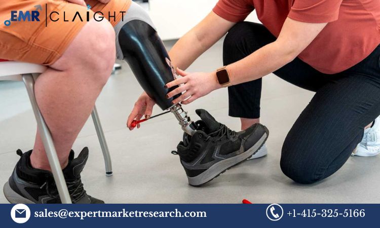 Read more about the article Global Prosthetics and Orthotics Market Size, Share, Price, Trends, Growth, Analysis, Report and Forecast 2024-2032