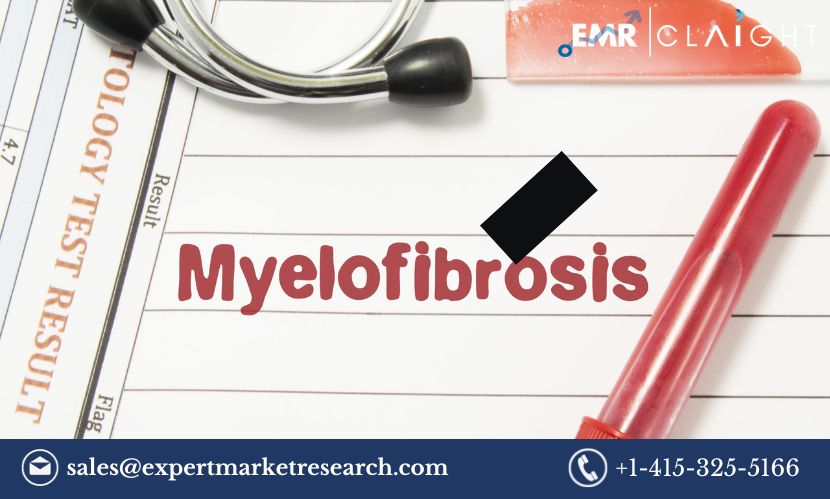 Read more about the article Secondary Myelofibrosis Therapeutics Market Size, Share, Price, Trends, Growth, Analysis, Report and Forecast 2024-2032