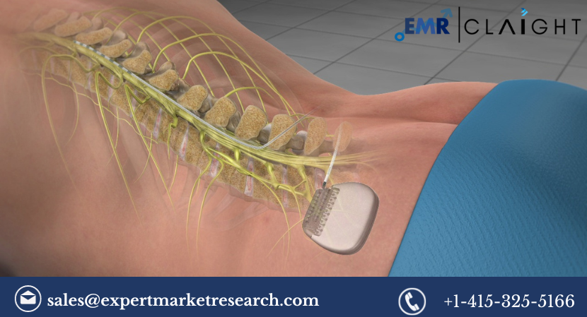 Read more about the article Spinal Cord Stimulation Market Size, Share, Growth, Report and Forecast 2024-2032