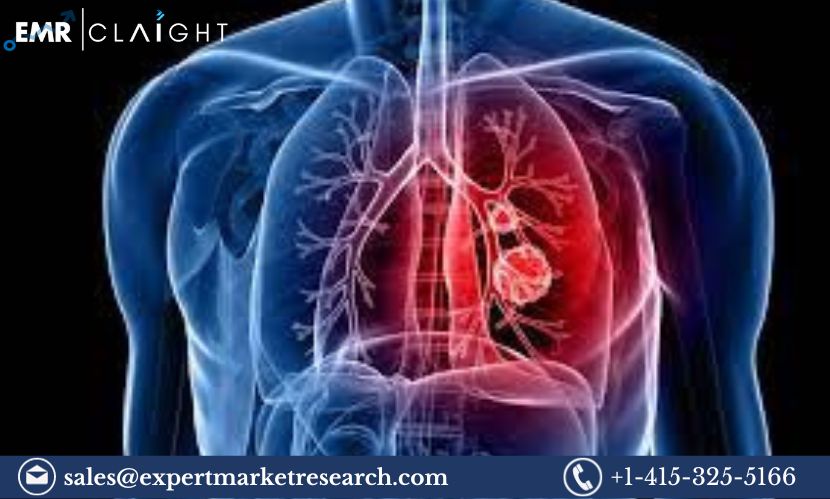 Read more about the article Global Thoracic Surgery Market Size, Share, Price, Trends, Growth, Analysis, Report and Forecast 2024-2032