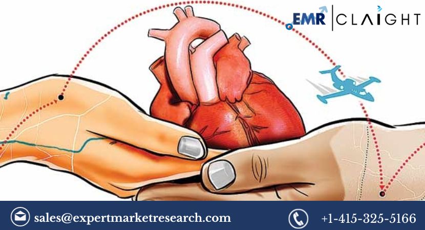 Read more about the article Global Transplantation Market Size, Share, Report and Forecast 2024-2032