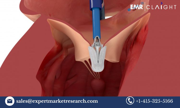 Read more about the article Global Tricuspid Valve Repair Market Size, Share, Price, Trends, Growth, Analysis, Report and Forecast 2024-2032