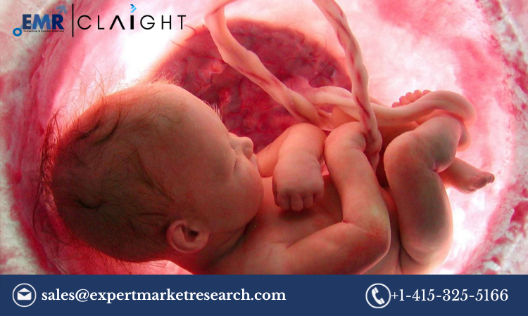 Read more about the article Global Umbilical Cord Blood Banking Market Report and Forecast 2024-2032