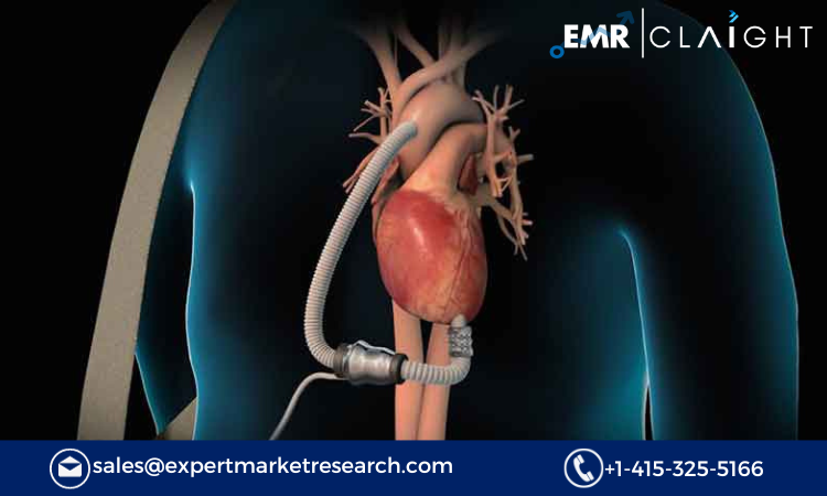 Read more about the article Ventricular Assist Device Market Size, Share, Report and Forecast 2024-2032