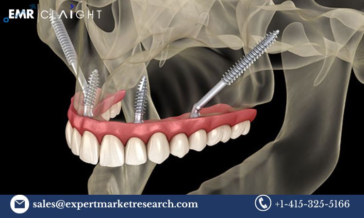 Read more about the article Global Zygomatic and Pterygoid Implants Market Size, Share, Price, Trends, Growth, Analysis, Report and Forecast 2024-2032