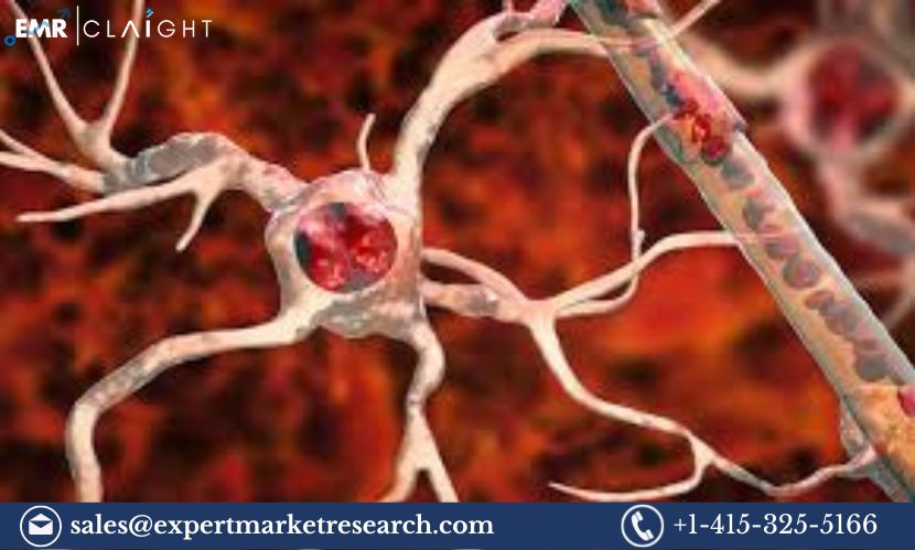 Read more about the article Global Amyotrophic Lateral Sclerosis Market Size, Share, Price, Trends, Growth, Analysis, Report and Forecast 2024-2032