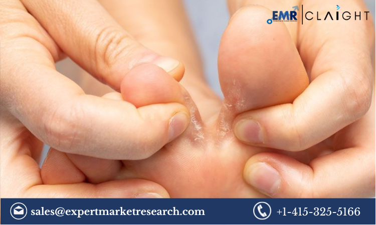 Read more about the article Athlete’s Foot Treatment Market Size, Share, Report and Forecast 2024-2032