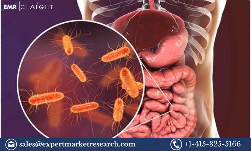 Read more about the article Global Cancer Microbiome Market Size, Share, Price, Trends, Growth, Analysis, Report and Forecast 2024-2032