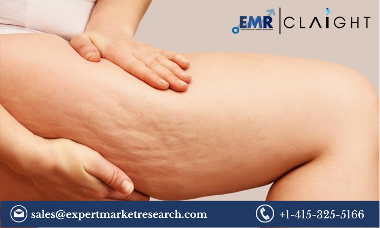 Read more about the article Cellulite Treatment Market Share, Trends, Report and Forecast 2024-2032