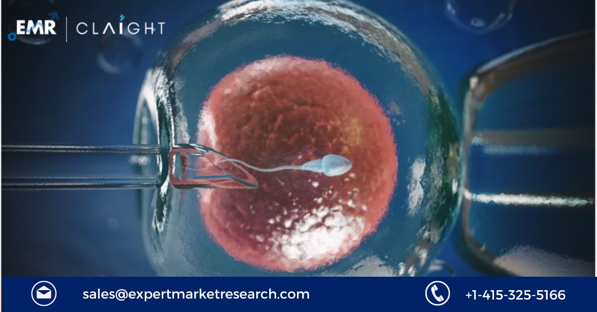 Read more about the article Global Cryopreservation for In-Vitro Fertilization (Ivf) Market Size, Share, Price, Trends, Growth, Analysis, Report and Forecast 2024-2032