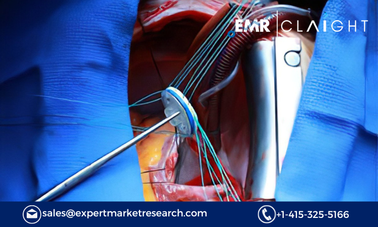 Read more about the article Heart Valve Devices Market Size, Share, Report and Forecast 2024-2032