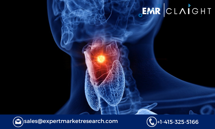 Read more about the article Laryngeal Cancer Therapeutics Market Size, Share, Report and Forecast 2024-2032