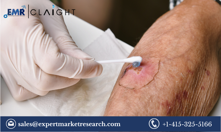 Read more about the article Negative Pressure Wound Therapy (NPWT) Market Size, Share, Growth Report and Forecast 2024-2032