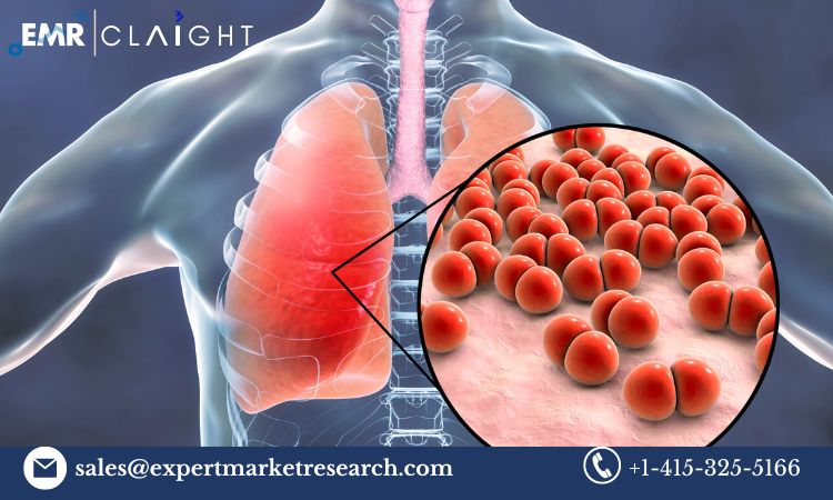 Read more about the article Global Pathogen Reduction Systems Market Size, Share, Price, Trends, Growth, Analysis, Report and Forecast 2024-2032