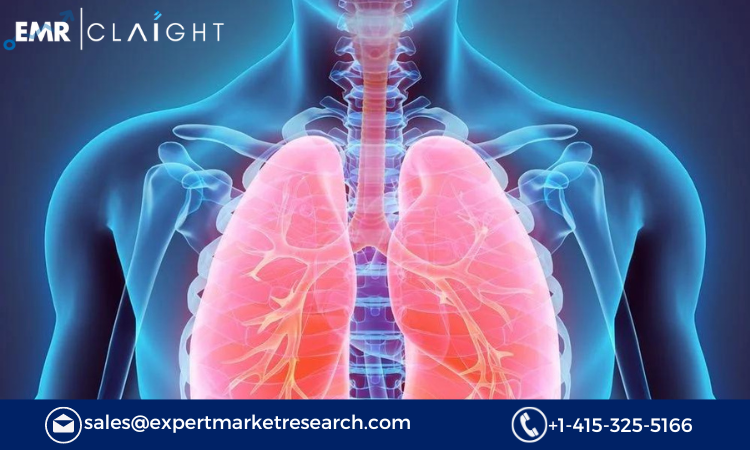 Read more about the article Pulmonary Drug Delivery Systems Market Report and Forecast 2024-2032