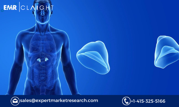 Read more about the article Congenital Adrenal Hyperplasia Treatment Market Report and Forecast 2024-2032