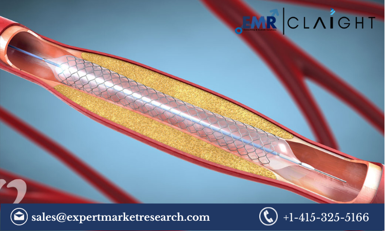 Read more about the article Stents Market Share, Size, Trends, Report and Forecast 2024-2032