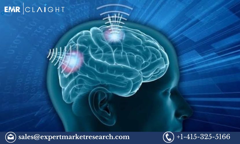 Read more about the article Global Wireless Brain Sensors Market Size, Share, Price, Trends, Growth, Analysis, Report and Forecast 2024-2032