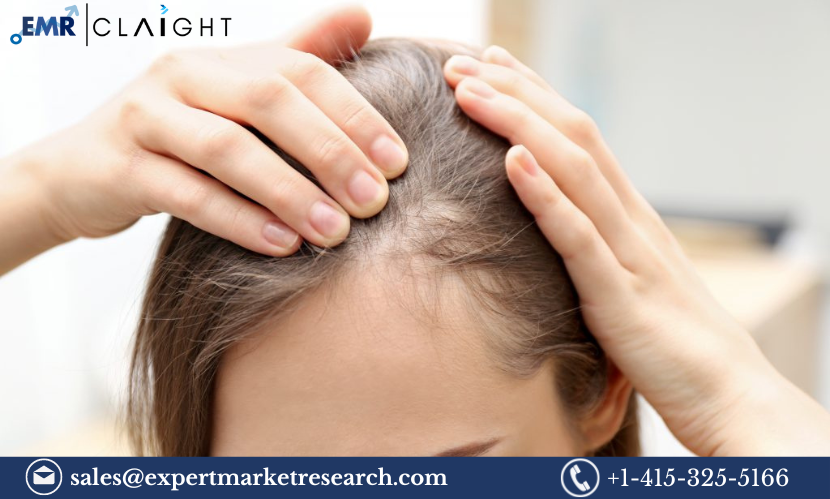 Read more about the article Alopecia Areata Market Size, Share, Trends Report and Forecast 2024-2032