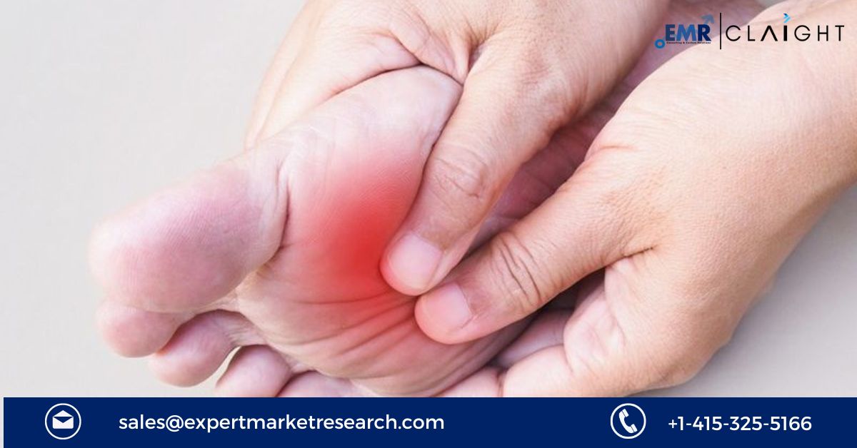 Read more about the article Diabetic Neuropathy Treatment Market Size, Share, Trends, Outlook, Growth, Analysis, Report and Forecast 2024-2032