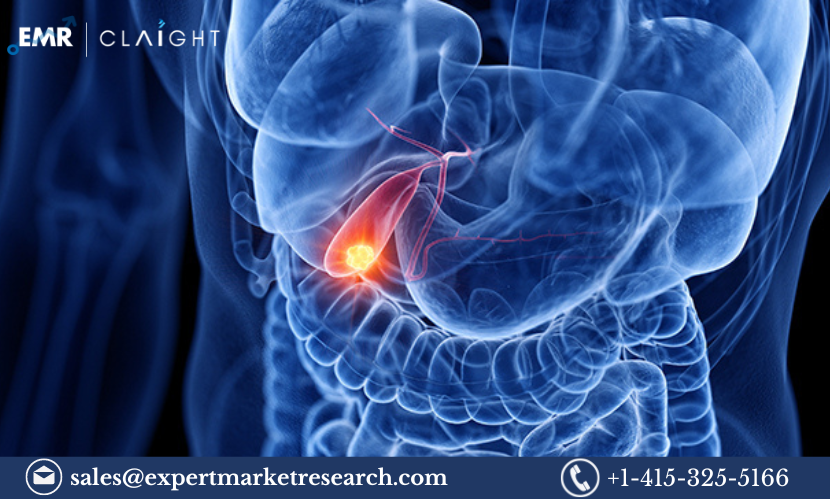 Read more about the article Gallbladder Cancer Market Size, Share Report and Forecast 2024-2032