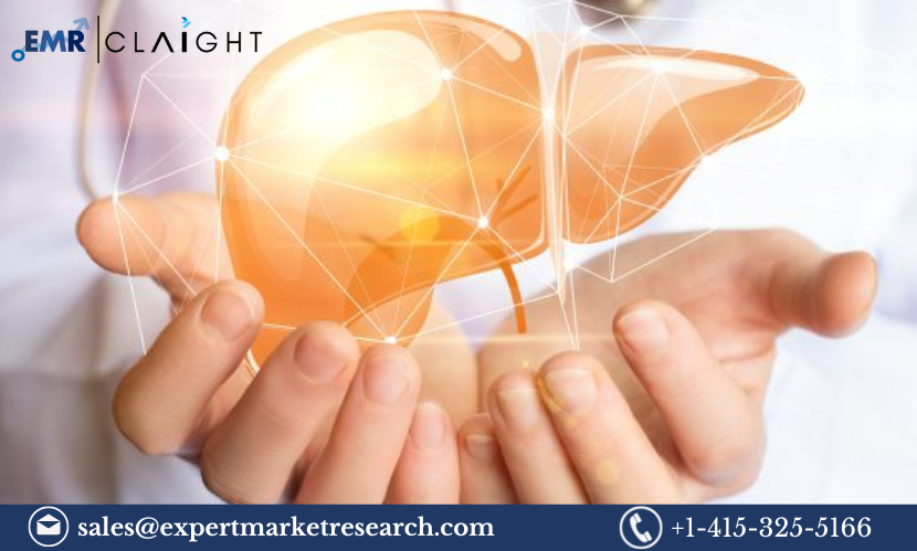 Read more about the article Hepatic Encephalopathy Treatment Market Size, Share, Report and Forecast 2024-2032