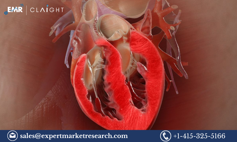 Read more about the article Myocarditis Market Size, Share, Trends, Growth, Report and Forecast 2024-2032