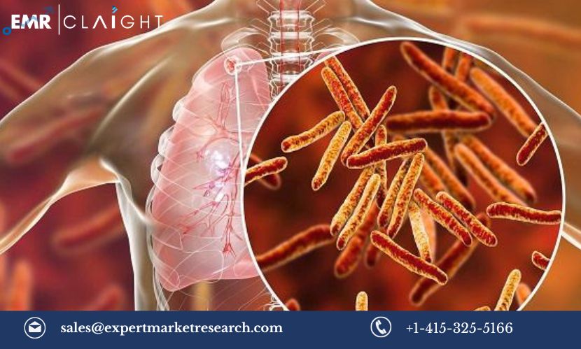 Read more about the article Anti Tuberculosis Therapeutics Market Size, Share, Trends, Growth, Analysis, Report and Forecast 2024-2032