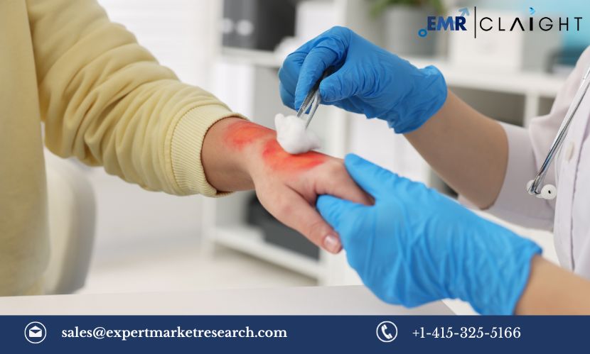 Read more about the article Burn Pain Market Size, Share, Trends, Growth, Report and Forecast 2024-2032