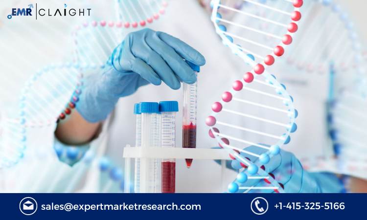 Read more about the article Global Direct-to-Consumer Laboratory Testing Market Size, Share, Trends, Outlook, Growth, Analysis, Report and Forecast 2024-2032