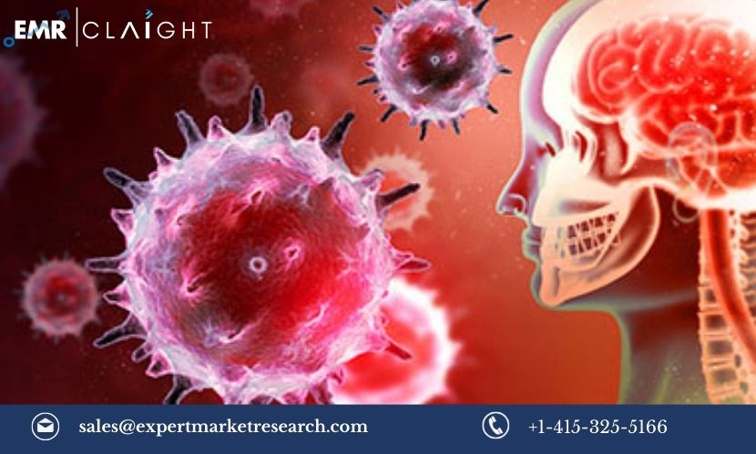 Read more about the article Encephalitis Market Size, Share, Trends, Growth, Report and Forecast 2024-2032