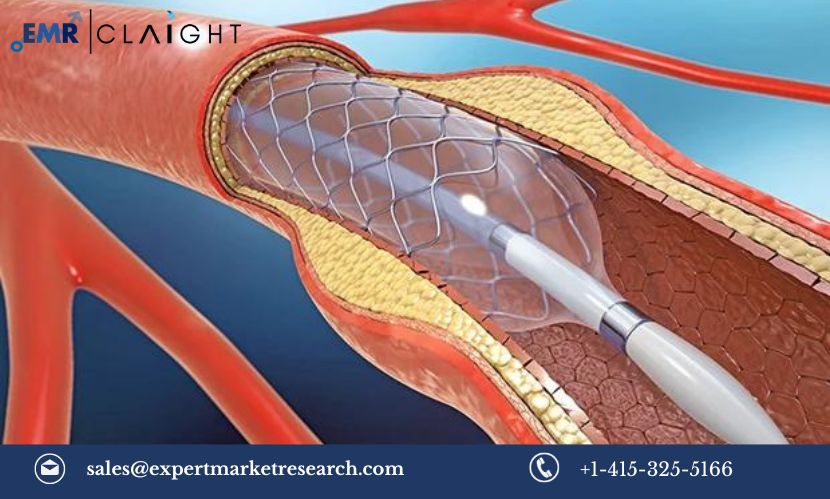 Read more about the article Global Coronary Stents Market Size, Share, Trends, Outlook, Growth, Analysis, Report and Forecast 2024-2032