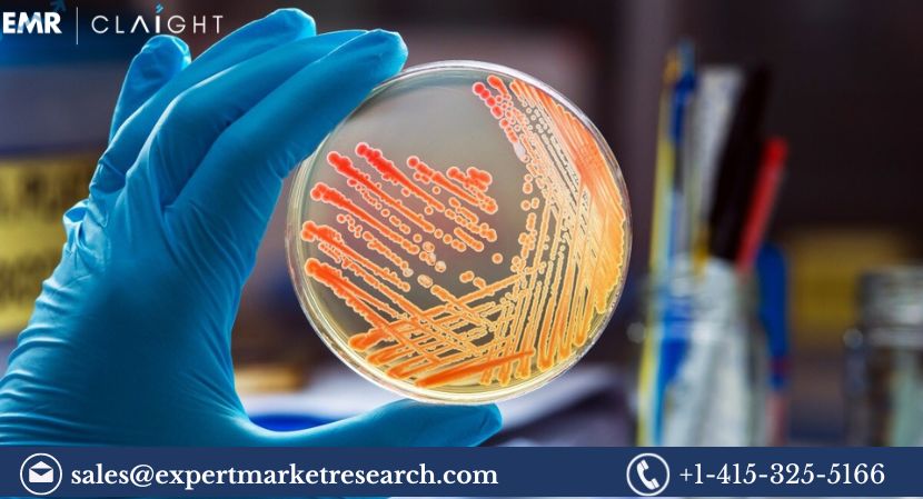 Read more about the article Global Industrial Microbiology Testing Services Market Size, Share, Trends, Outlook, Growth, Analysis, Report and Forecast 2024-2032