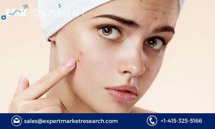 Read more about the article Acne Therapeutics Market Size, Share, Trends, Outlook, Growth, Analysis, Report and Forecast 2024-2032