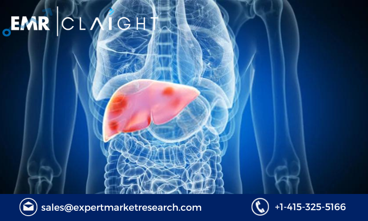 Read more about the article Primary Sclerosing Cholangitis Market Size, Share Report and Forecast 2024-2032